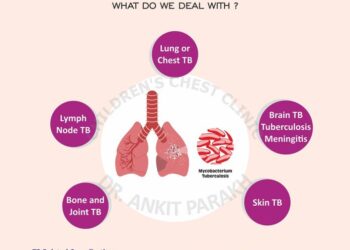 Zim battles to save children from tuberculosis