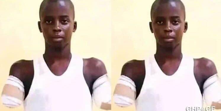 Uncle cuts off the two hands of his 12-year-old nephew over alleged phone theft