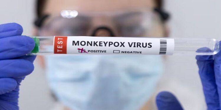 SA records surge in MPox cases