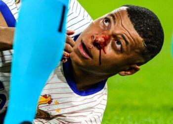 Mbappe sustains a broken nose during France-Austria match