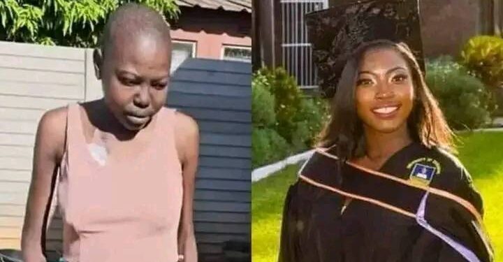 UZ graduate awaiting kidney transplant in India d!es