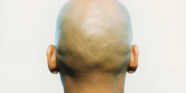 ‘Bald men targeted for ritual k!llings in Mozambique’