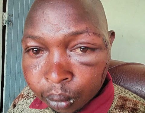 Kenyan man heavily b3aten by presidential guard after mocking Ruto’s motorcade
