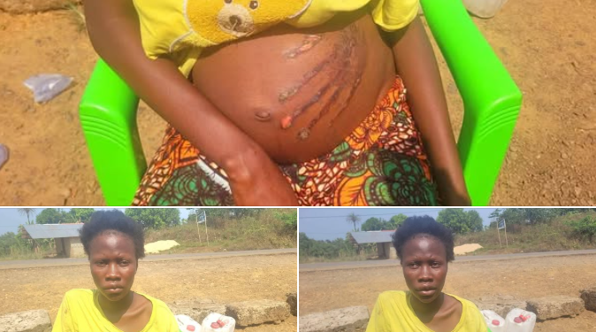 SH0CKING VIDEO: Pregnant woman finds bloody handprint on stomach after having bad dreaming
