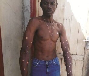 Kombi Driver Alleges Brutal Assault by Employer